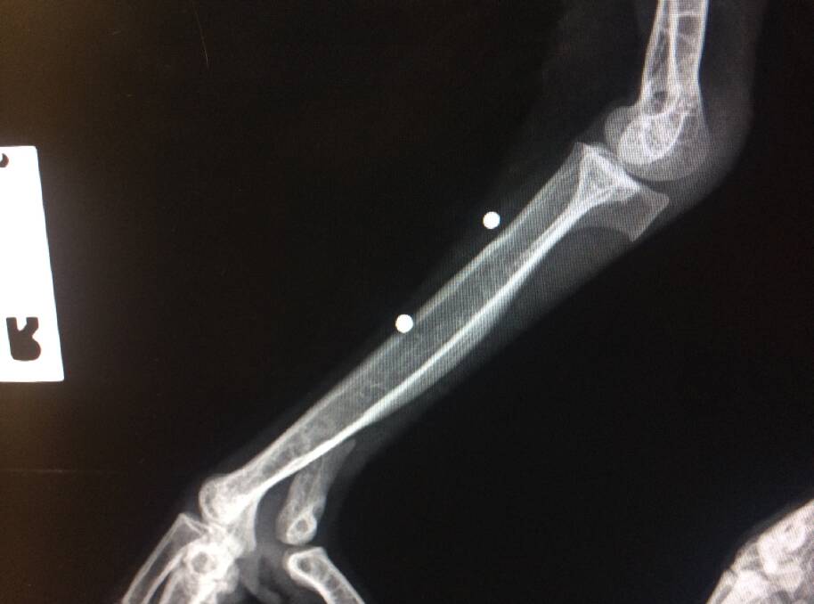 An x-ray of the eagle's wounds.