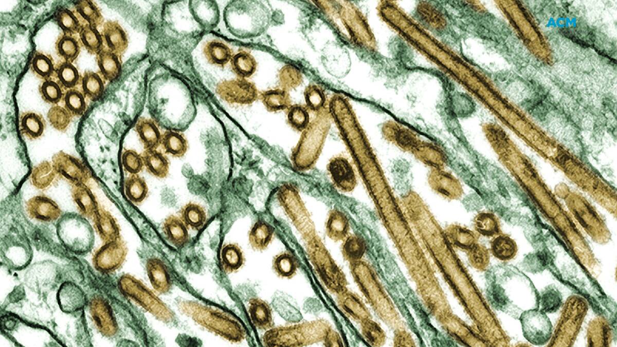 An electron micrograph provided by the Centers for Disease Control showing the bird influenza virus strain H5N1. Picture via AP Photo/Centers for Disease Control/C. Goldsmith