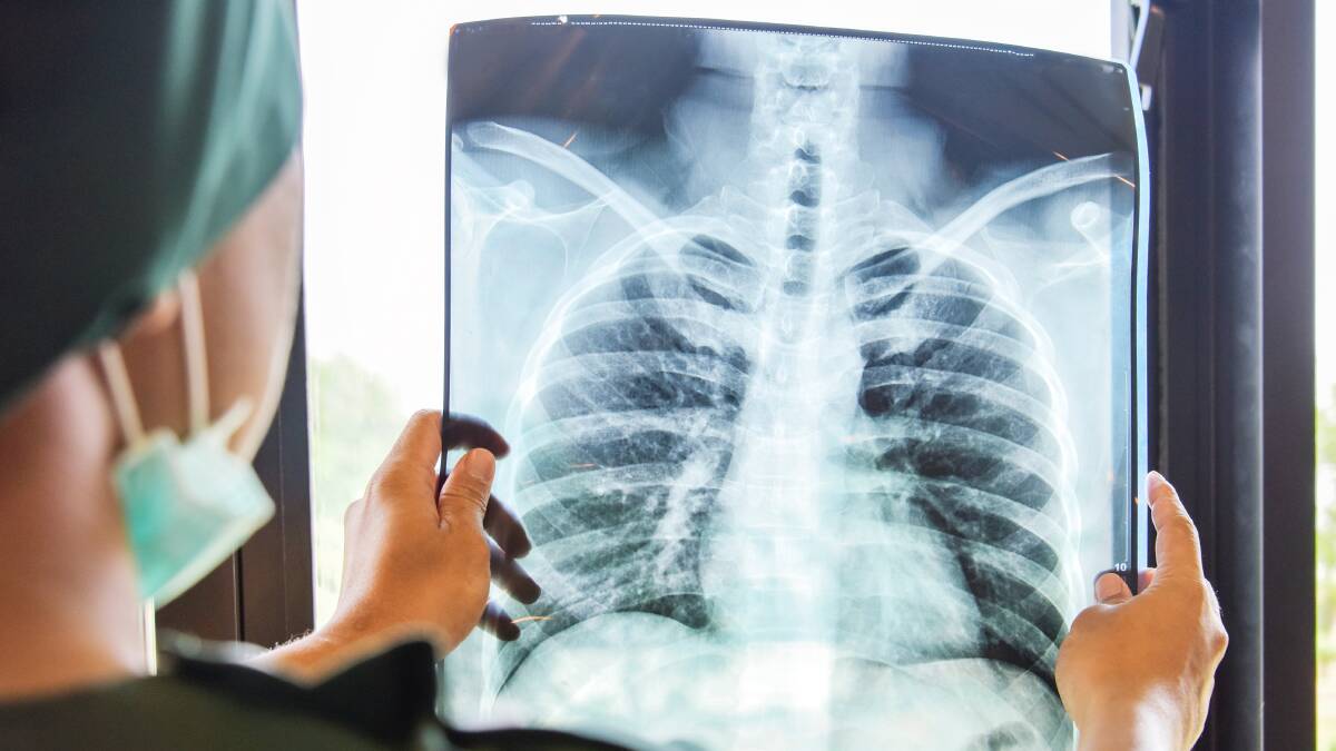 Tuberculosis is still killing thousands of people a day. Where's the urgency? Picture Shutterstock